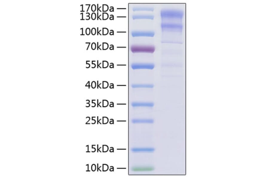 SDS-PAGE - Recombinant Human LDLR Protein (C-terminal His Tag) (A330992) - Antibodies.com