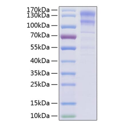 SDS-PAGE - Recombinant Human LDLR Protein (C-terminal His Tag) (A330992) - Antibodies.com