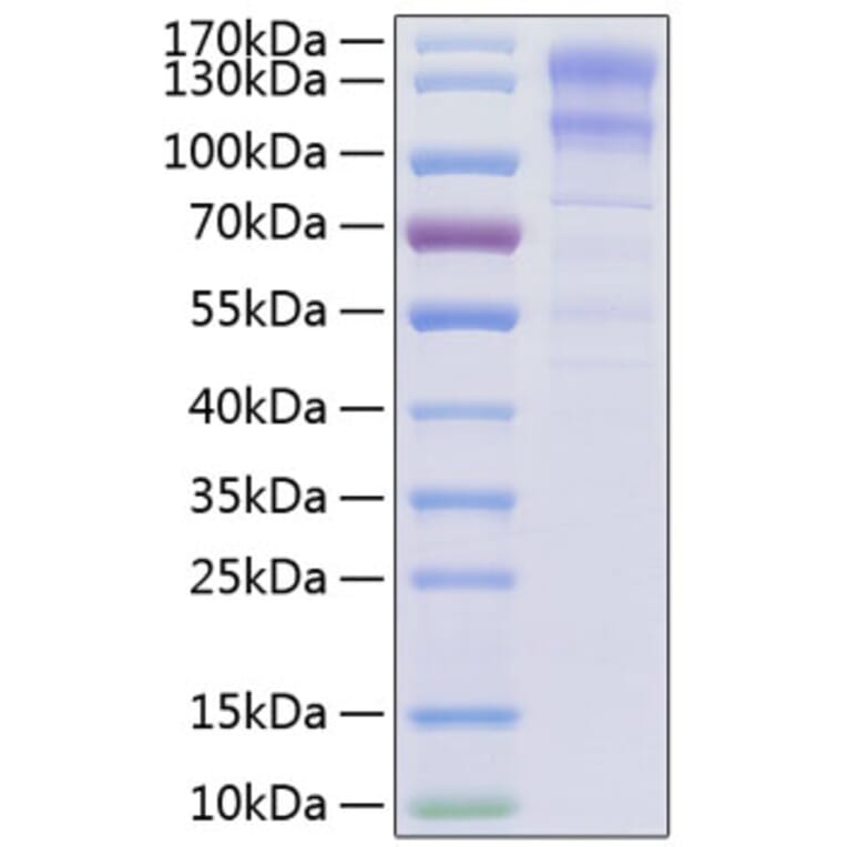 SDS-PAGE - Recombinant Human LDLR Protein (C-terminal His Tag) (A330992) - Antibodies.com