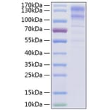 SDS-PAGE - Recombinant Human LDLR Protein (C-terminal His Tag) (A330992) - Antibodies.com
