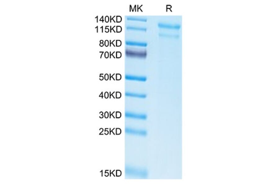 Tris-Bis PAGE - Recombinant Human LDLR Protein (Biotin) (C-terminal His and Avi Tag) (A330993) - Antibodies.com