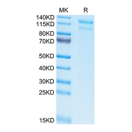 Tris-Bis PAGE - Recombinant Human LDLR Protein (Biotin) (C-terminal His and Avi Tag) (A330993) - Antibodies.com