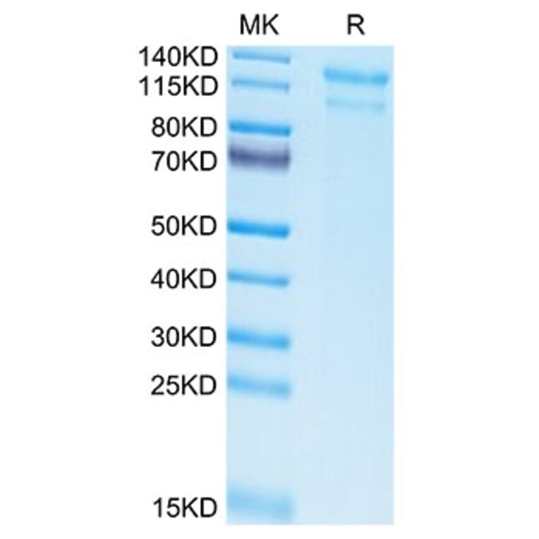 Tris-Bis PAGE - Recombinant Human LDLR Protein (Biotin) (C-terminal His and Avi Tag) (A330993) - Antibodies.com