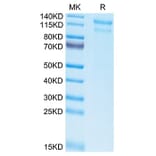 Tris-Bis PAGE - Recombinant Human LDLR Protein (Biotin) (C-terminal His and Avi Tag) (A330993) - Antibodies.com