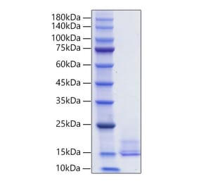 SDS-PAGE - Recombinant Human LEC Protein (C-terminal His Tag) (A330994) - Antibodies.com