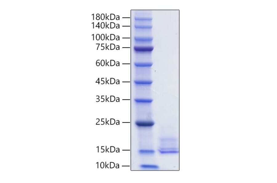 SDS-PAGE - Recombinant Human LEC Protein (C-terminal His Tag) (A330994) - Antibodies.com