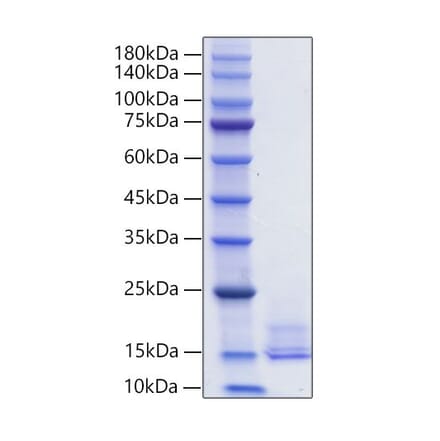 SDS-PAGE - Recombinant Human LEC Protein (C-terminal His Tag) (A330994) - Antibodies.com