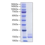 SDS-PAGE - Recombinant Human LEC Protein (C-terminal His Tag) (A330994) - Antibodies.com