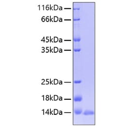 SDS-PAGE - Recombinant Human Leptin Protein (A330995) - Antibodies.com