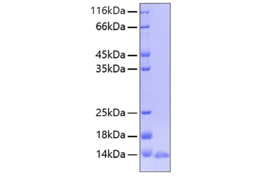 SDS-PAGE - Recombinant Human Leptin Protein (A330995) - Antibodies.com