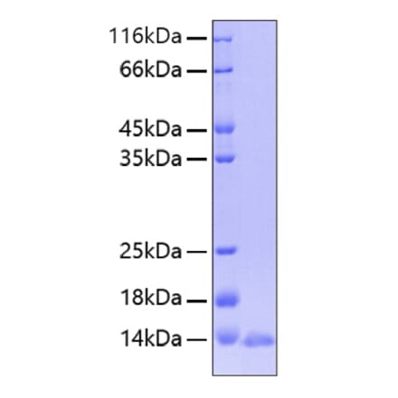 SDS-PAGE - Recombinant Human Leptin Protein (A330995) - Antibodies.com