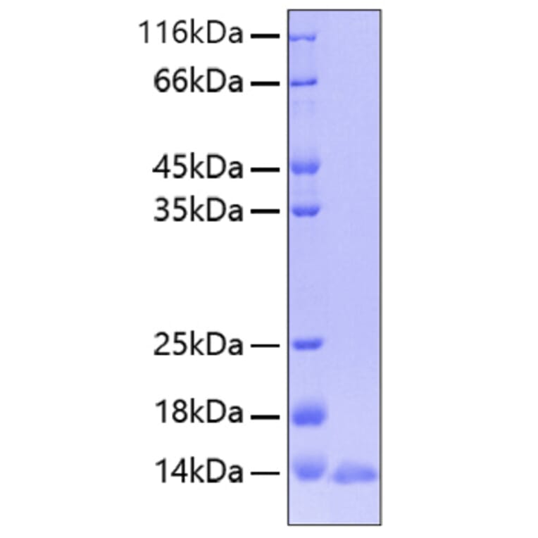 SDS-PAGE - Recombinant Human Leptin Protein (A330995) - Antibodies.com