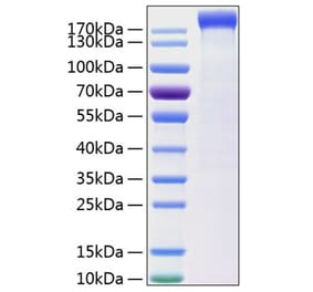 SDS-PAGE - Recombinant Human Leptin Receptor Protein (C-terminal Human Fc and His Tag) (A330996) - Antibodies.com