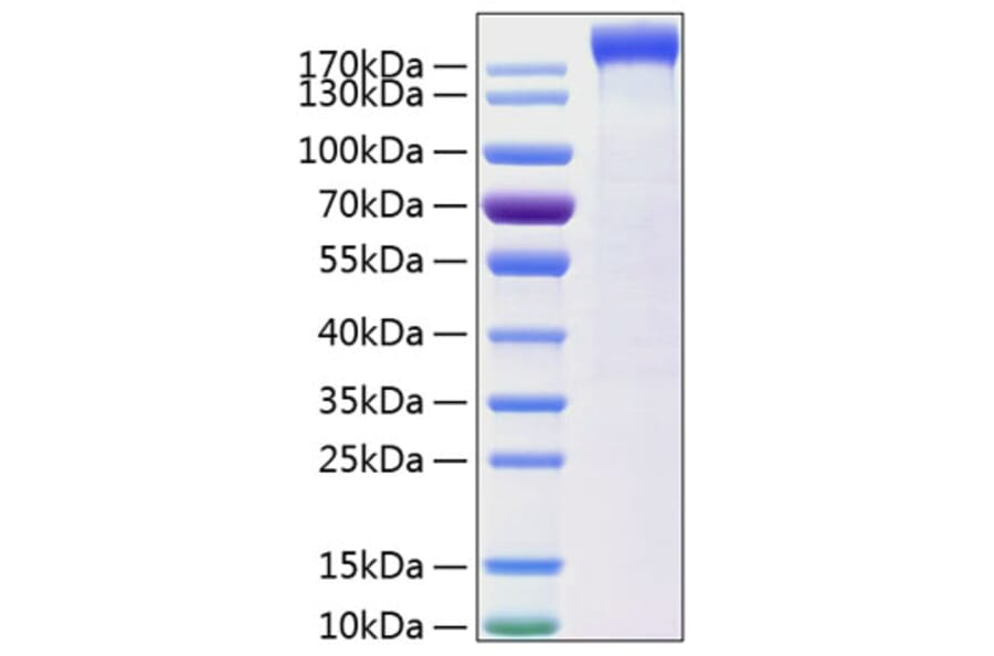SDS-PAGE - Recombinant Human Leptin Receptor Protein (C-terminal Human Fc and His Tag) (A330996) - Antibodies.com