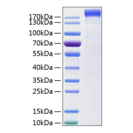 SDS-PAGE - Recombinant Human Leptin Receptor Protein (C-terminal Human Fc and His Tag) (A330996) - Antibodies.com