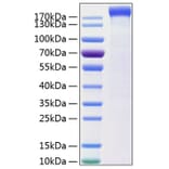 SDS-PAGE - Recombinant Human Leptin Receptor Protein (C-terminal Human Fc and His Tag) (A330996) - Antibodies.com