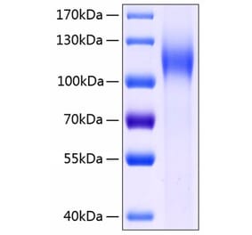 SDS-PAGE - Recombinant Human LI Cadherin Protein (C-terminal His Tag) (A330997) - Antibodies.com