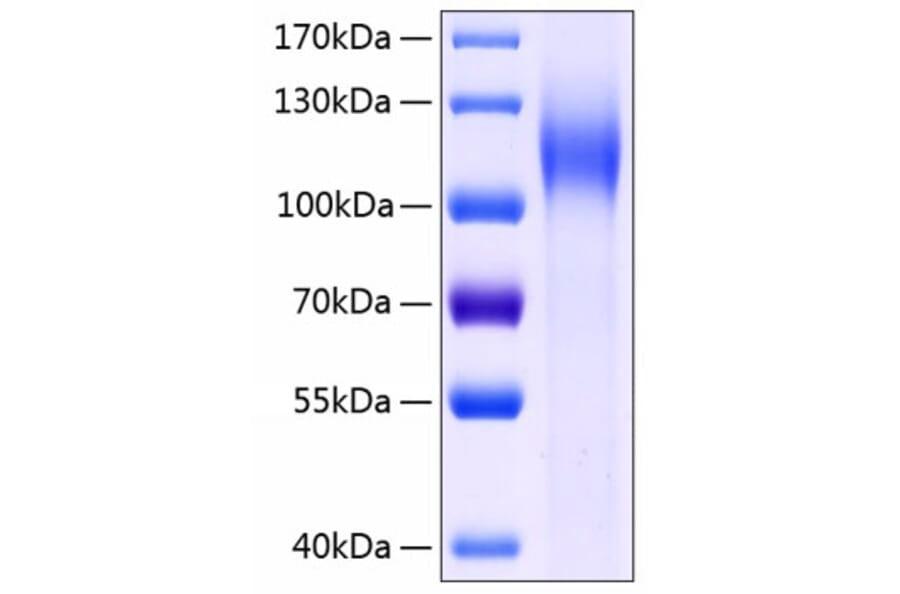 SDS-PAGE - Recombinant Human LI Cadherin Protein (C-terminal His Tag) (A330997) - Antibodies.com