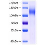 SDS-PAGE - Recombinant Human LI Cadherin Protein (C-terminal His Tag) (A330997) - Antibodies.com