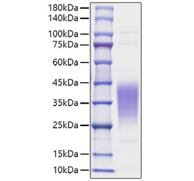 SDS-PAGE - Recombinant Human LIF Protein (A330998) - Antibodies.com