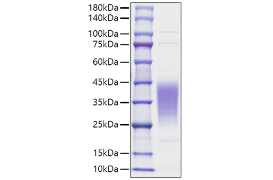 SDS-PAGE - Recombinant Human LIF Protein (A330998) - Antibodies.com