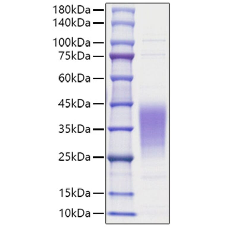 SDS-PAGE - Recombinant Human LIF Protein (A330998) - Antibodies.com