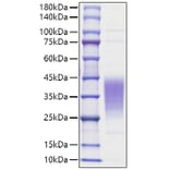 SDS-PAGE - Recombinant Human LIF Protein (A330998) - Antibodies.com