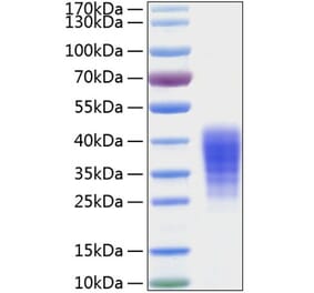 SDS-PAGE - Recombinant Human LIF Protein (C-terminal His Tag) (A330999) - Antibodies.com