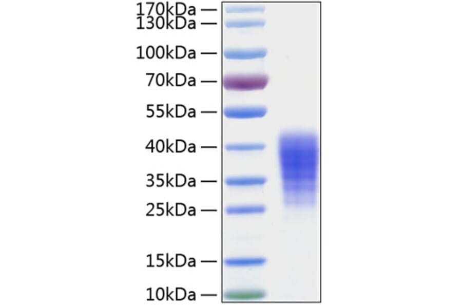 SDS-PAGE - Recombinant Human LIF Protein (C-terminal His Tag) (A330999) - Antibodies.com
