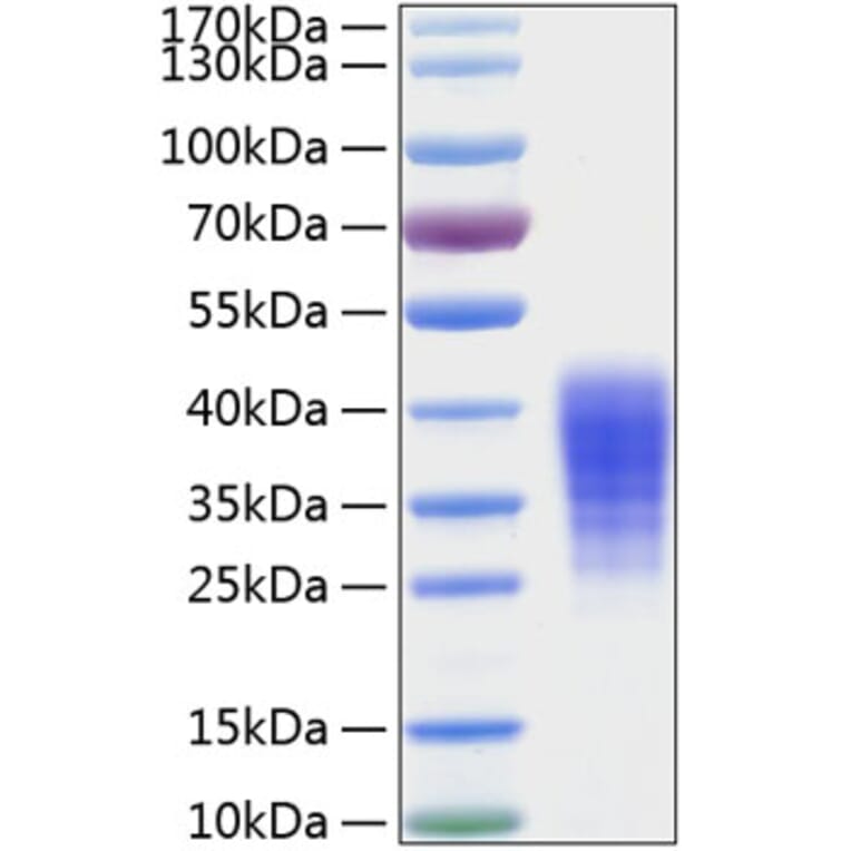 SDS-PAGE - Recombinant Human LIF Protein (C-terminal His Tag) (A330999) - Antibodies.com