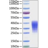 SDS-PAGE - Recombinant Human LIF Protein (C-terminal His Tag) (A330999) - Antibodies.com