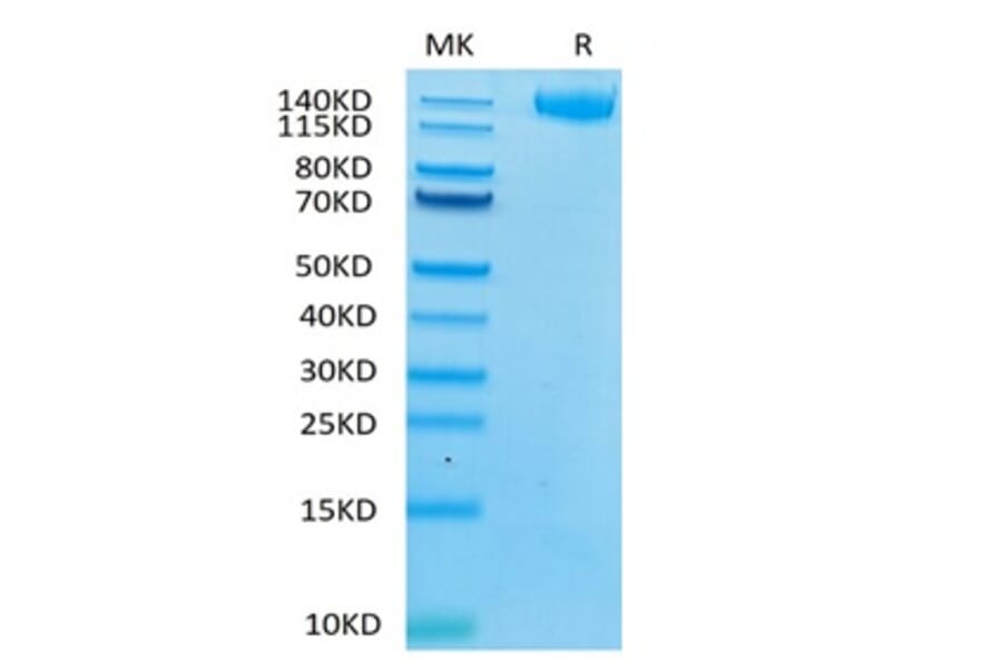 Tris-Bis PAGE - Recombinant Human LIFR Protein (C-terminal Human Fc Tag) (A331000) - Antibodies.com