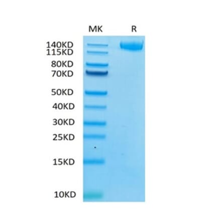 Tris-Bis PAGE - Recombinant Human LIFR Protein (C-terminal Human Fc Tag) (A331000) - Antibodies.com