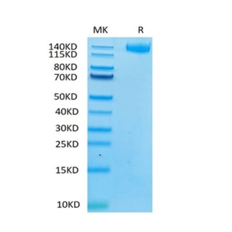 Tris-Bis PAGE - Recombinant Human LIFR Protein (C-terminal Human Fc Tag) (A331000) - Antibodies.com
