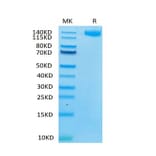 Tris-Bis PAGE - Recombinant Human LIFR Protein (C-terminal Human Fc Tag) (A331000) - Antibodies.com