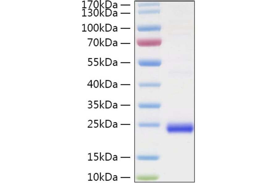 SDS-PAGE - Recombinant Human LIGHT Protein (N-terminal His Tag) (A331001) - Antibodies.com