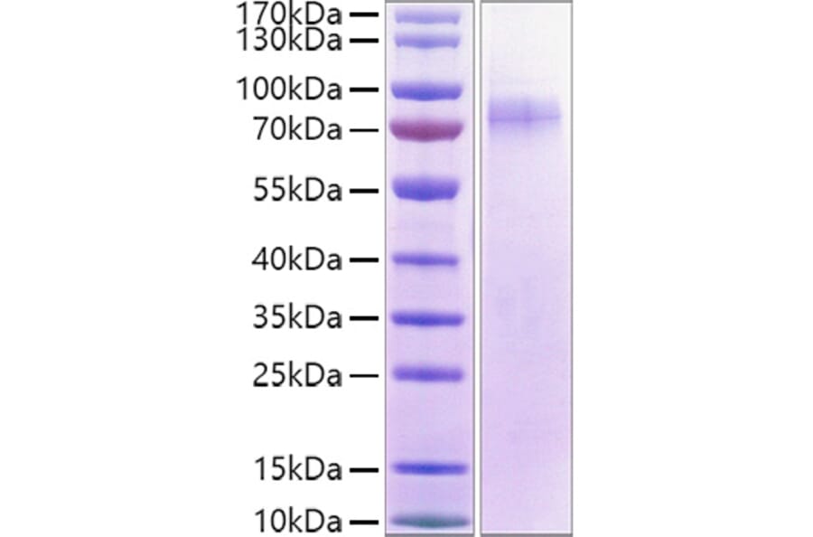 SDS-PAGE - Recombinant Human LILRA1 Protein (C-terminal His and Avi Tag) (A331002) - Antibodies.com