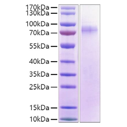 SDS-PAGE - Recombinant Human LILRA1 Protein (C-terminal His and Avi Tag) (A331002) - Antibodies.com