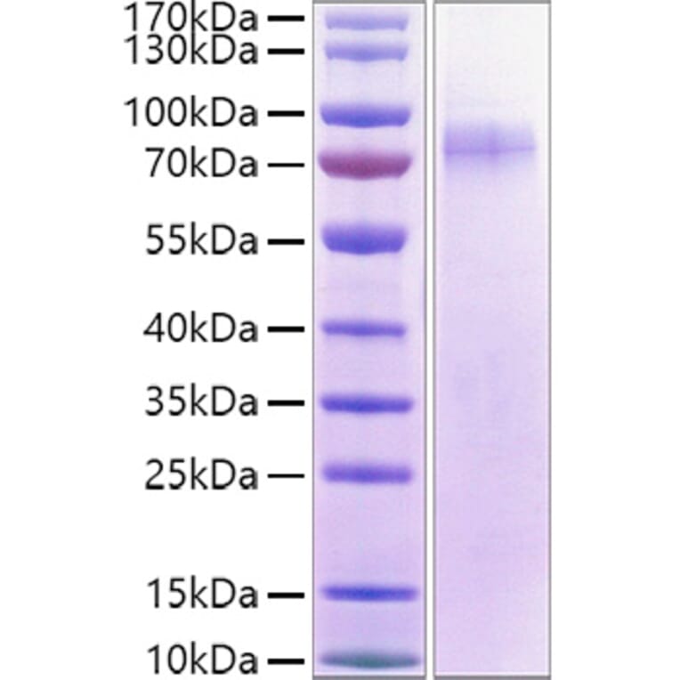 SDS-PAGE - Recombinant Human LILRA1 Protein (C-terminal His and Avi Tag) (A331002) - Antibodies.com