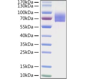 SDS-PAGE - Recombinant Human LILRA2 Protein (C-terminal His Tag) (A331003) - Antibodies.com