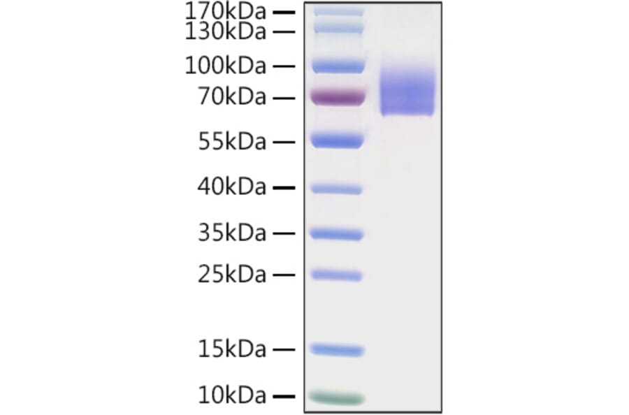 SDS-PAGE - Recombinant Human LILRA2 Protein (C-terminal His Tag) (A331003) - Antibodies.com
