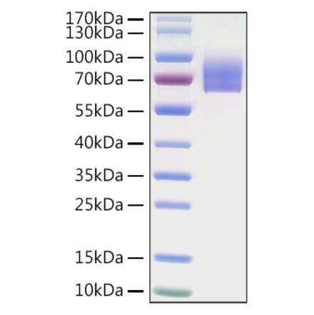 SDS-PAGE - Recombinant Human LILRA2 Protein (C-terminal His Tag) (A331003) - Antibodies.com