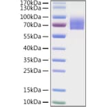 SDS-PAGE - Recombinant Human LILRA2 Protein (C-terminal His Tag) (A331003) - Antibodies.com