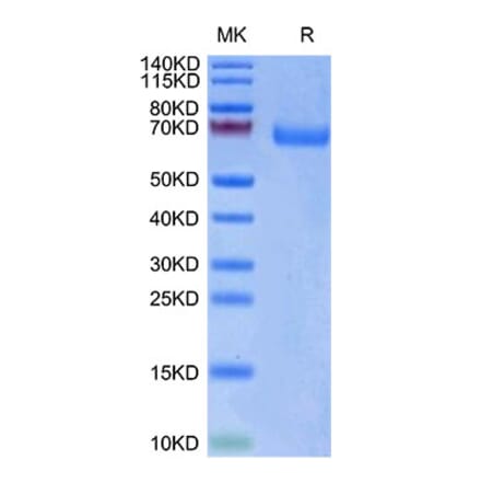 Tris-Bis PAGE - Recombinant Human LILRA3 Protein (Biotin) (C-terminal His and Avi Tag) (A331004) - Antibodies.com