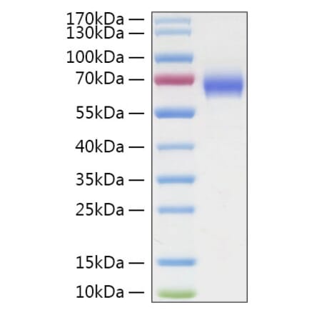 SDS-PAGE - Recombinant Human LILRA3 Protein (C-terminal His Tag) (A331005) - Antibodies.com