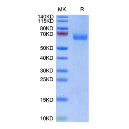 Tris-Bis PAGE - Recombinant Human LILRA4 Protein (Biotin) (C-terminal His and Avi Tag) (A331006) - Antibodies.com