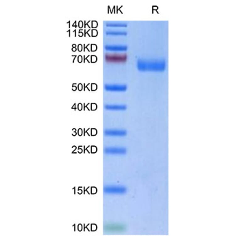 Tris-Bis PAGE - Recombinant Human LILRA4 Protein (Biotin) (C-terminal His and Avi Tag) (A331006) - Antibodies.com