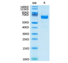 Tris-Bis PAGE - Recombinant Human LILRA4 Protein (C-terminal His and Avi Tag) (A331007) - Antibodies.com