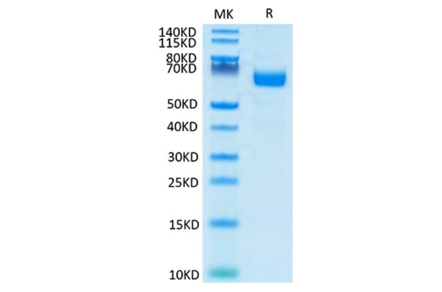 Tris-Bis PAGE - Recombinant Human LILRA4 Protein (C-terminal His and Avi Tag) (A331007) - Antibodies.com