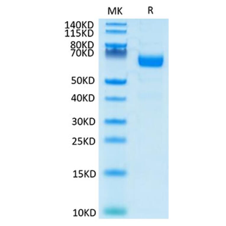 Tris-Bis PAGE - Recombinant Human LILRA4 Protein (C-terminal His and Avi Tag) (A331007) - Antibodies.com